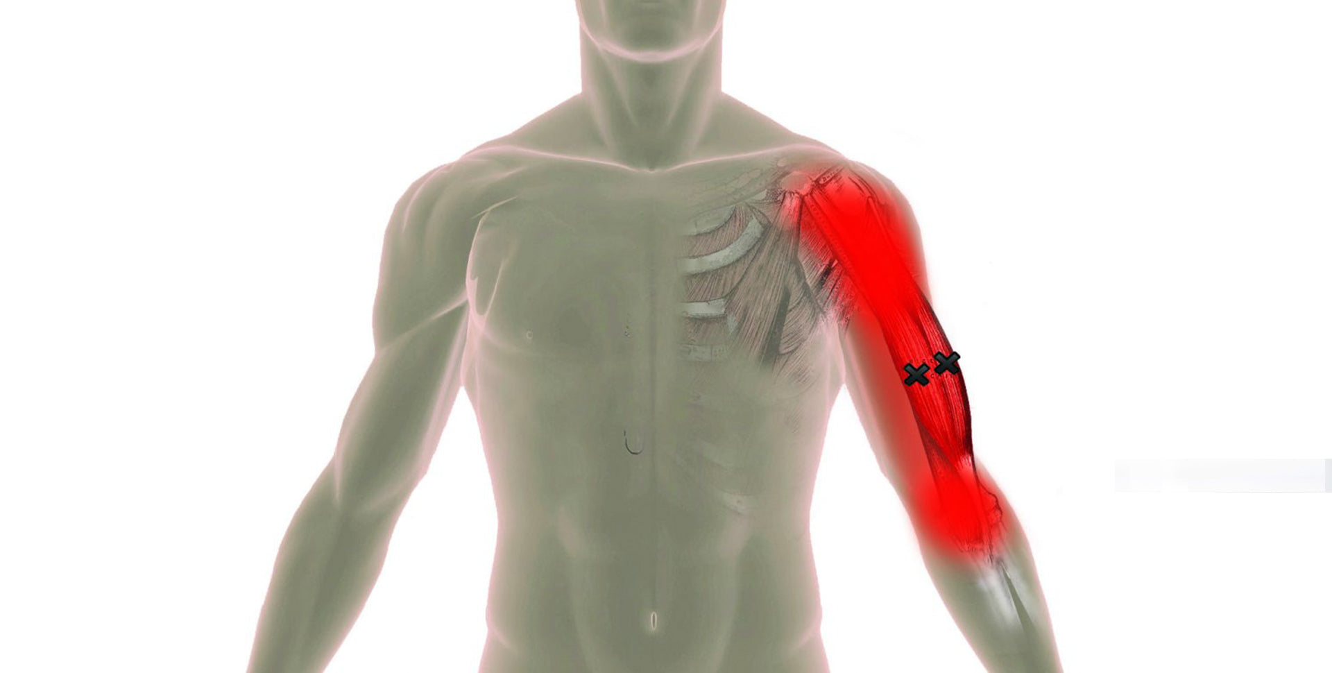 Bicep Pain Types, Causes, Treatment and Prevention Born Tough Bicep Pain Types, Causes, Treatment and Prevention Born Tough